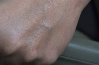 Что делать, если заклинило ручник